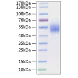 SDS-PAGE - Recombinant Human CD64 Protein (C-terminal His Tag) (A330378) - Antibodies.com