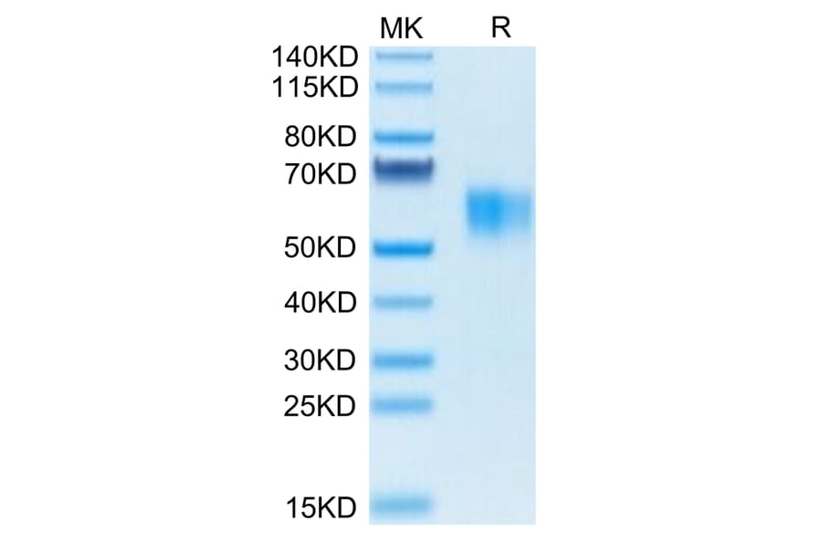 Tris-Bis PAGE - Recombinant Human CD64 Protein (Biotin) (C-terminal His and Avi Tag) (A330379) - Antibodies.com