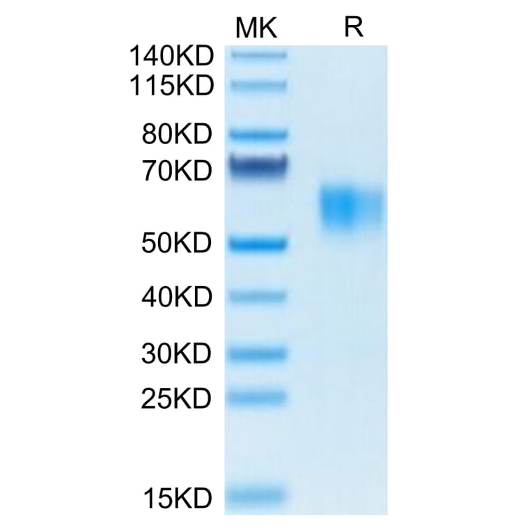 Tris-Bis PAGE - Recombinant Human CD64 Protein (Biotin) (C-terminal His and Avi Tag) (A330379) - Antibodies.com