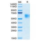 Tris-Bis PAGE - Recombinant Human CD64 Protein (Biotin) (C-terminal His and Avi Tag) (A330379) - Antibodies.com