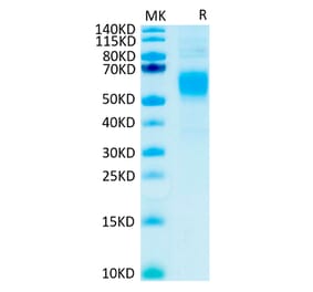 Tris-Bis PAGE - Recombinant Human CD64 Protein (C-terminal His and Avi Tag) (A330380) - Antibodies.com