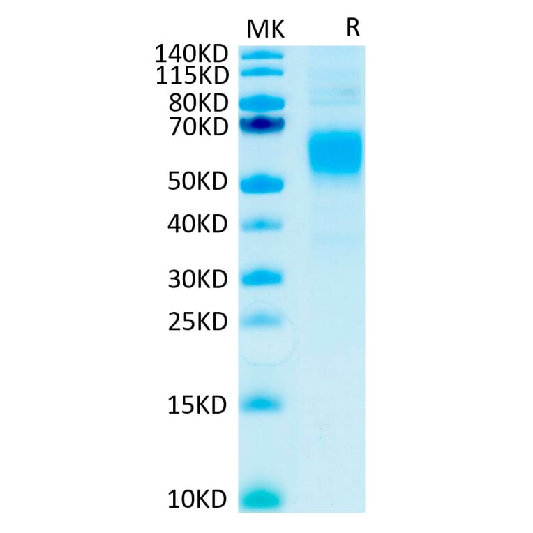 Tris-Bis PAGE - Recombinant Human CD64 Protein (C-terminal His and Avi Tag) (A330380) - Antibodies.com