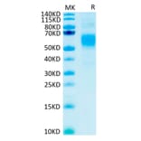 Tris-Bis PAGE - Recombinant Human CD64 Protein (C-terminal His and Avi Tag) (A330380) - Antibodies.com