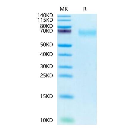 Tris-Bis PAGE - Recombinant Human CD66b Protein (Biotin) (C-terminal His and Avi Tag) (A330381) - Antibodies.com
