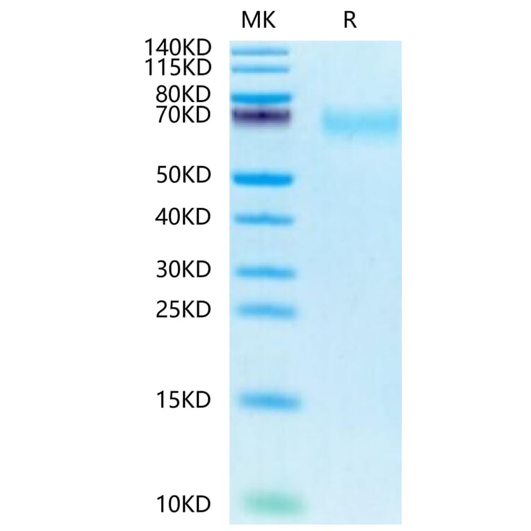 Tris-Bis PAGE - Recombinant Human CD66b Protein (Biotin) (C-terminal His and Avi Tag) (A330381) - Antibodies.com