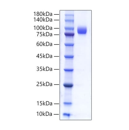 SDS-PAGE - Recombinant Human CD66b Protein (C-terminal Human Fc Tag) (A330382) - Antibodies.com