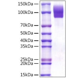 SDS-PAGE - Recombinant Human CD68 Protein (C-terminal Rabbit Fc Tag) (A330383) - Antibodies.com