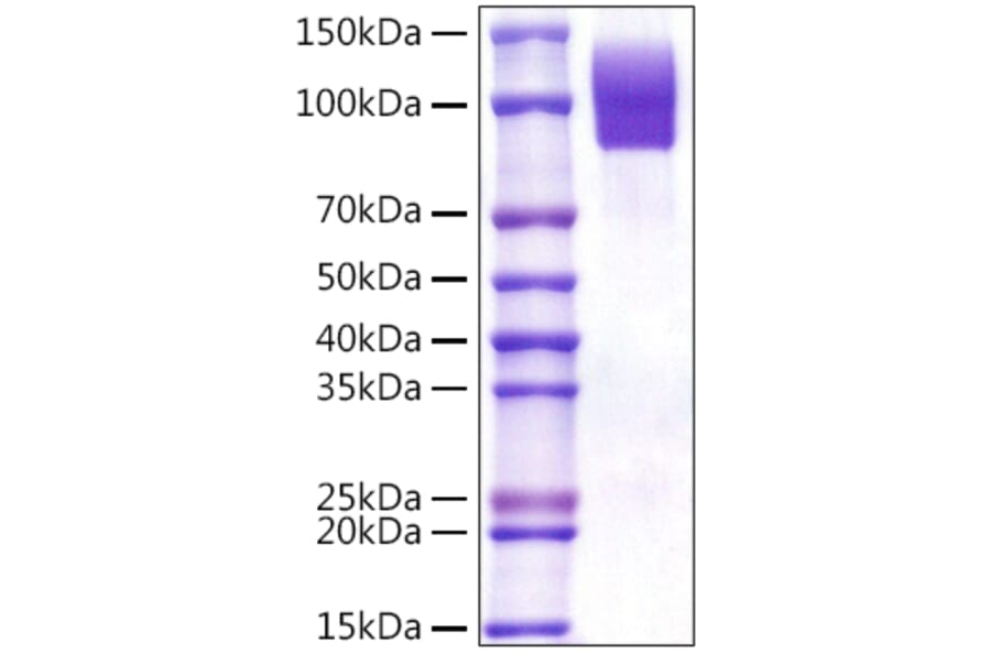 SDS-PAGE - Recombinant Human CD68 Protein (C-terminal Rabbit Fc Tag) (A330383) - Antibodies.com
