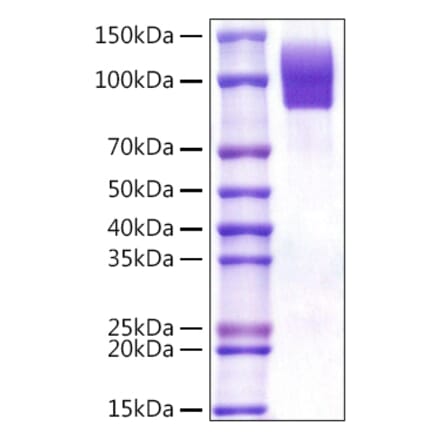 SDS-PAGE - Recombinant Human CD68 Protein (C-terminal Rabbit Fc Tag) (A330383) - Antibodies.com