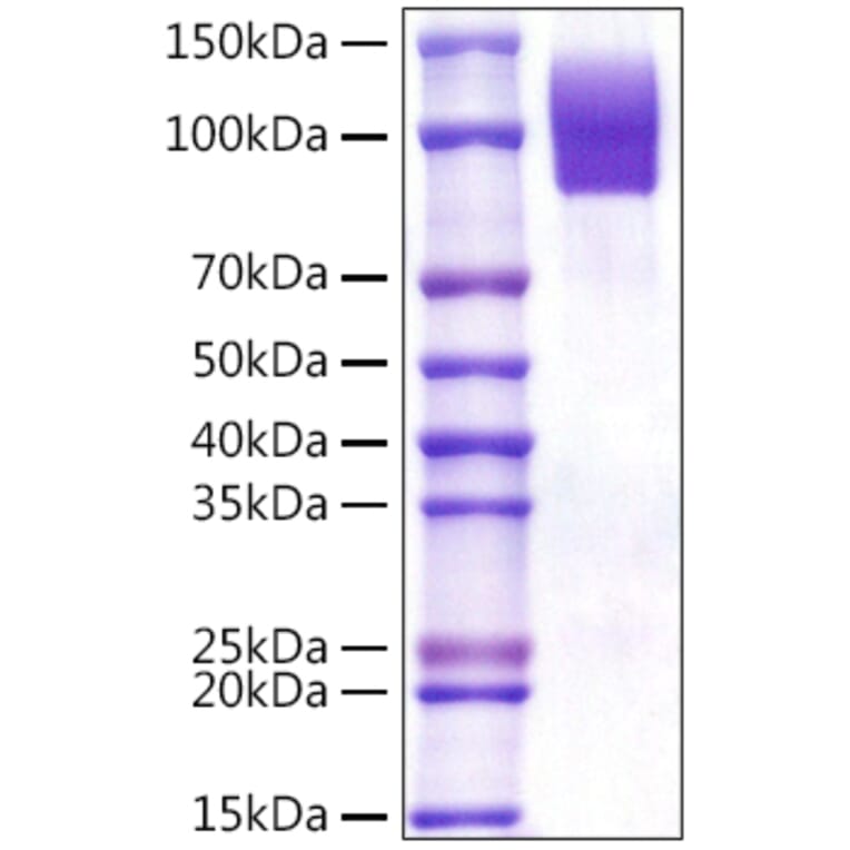 SDS-PAGE - Recombinant Human CD68 Protein (C-terminal Rabbit Fc Tag) (A330383) - Antibodies.com