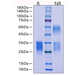 SDS-PAGE - Recombinant Mouse CD69 Protein (C-terminal His Tag) (A330384) - Antibodies.com