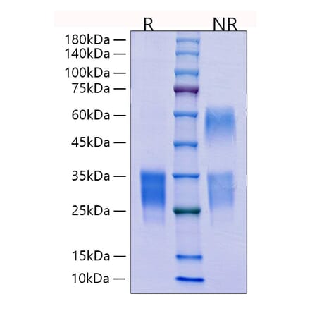 SDS-PAGE - Recombinant Mouse CD69 Protein (C-terminal His Tag) (A330384) - Antibodies.com
