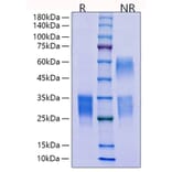 SDS-PAGE - Recombinant Mouse CD69 Protein (C-terminal His Tag) (A330384) - Antibodies.com