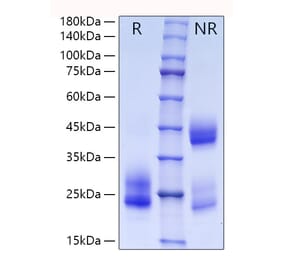 SDS-PAGE - Recombinant Human CD69 Protein (C-terminal His Tag) (A330385) - Antibodies.com