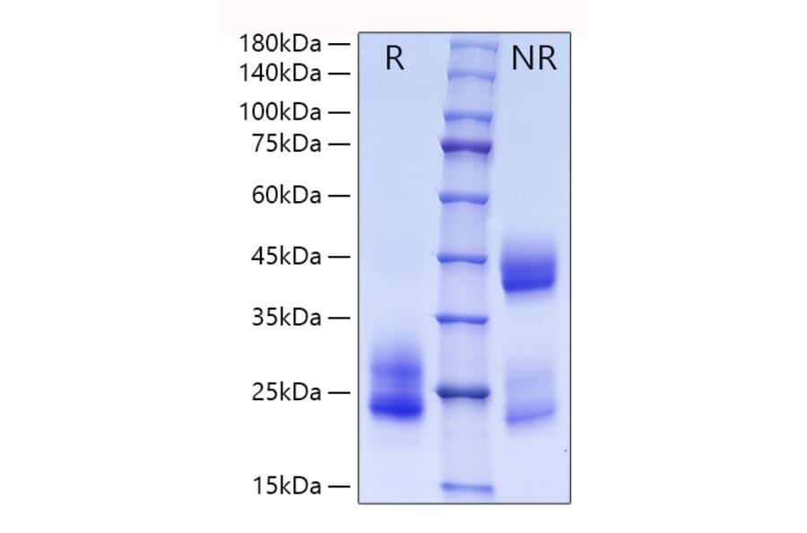 SDS-PAGE - Recombinant Human CD69 Protein (C-terminal His Tag) (A330385) - Antibodies.com