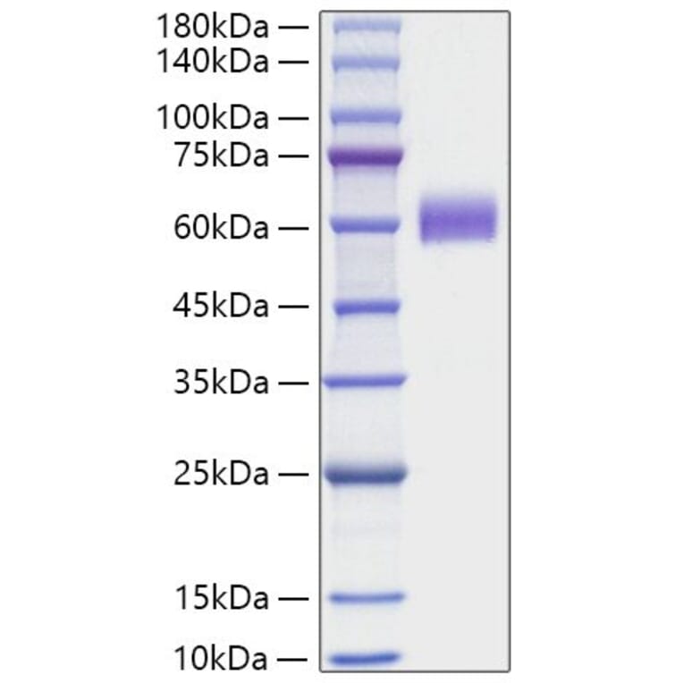 SDS-PAGE - Recombinant Human CD7 Protein (C-terminal Human Fc Tag) (A330386) - Antibodies.com