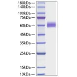 SDS-PAGE - Recombinant Human CD7 Protein (C-terminal Human Fc Tag) (A330386) - Antibodies.com