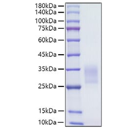 SDS-PAGE - Recombinant Human CD7 Protein (C-terminal His Tag) (A330387) - Antibodies.com