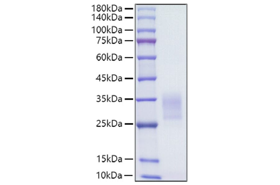 SDS-PAGE - Recombinant Human CD7 Protein (C-terminal His Tag) (A330387) - Antibodies.com