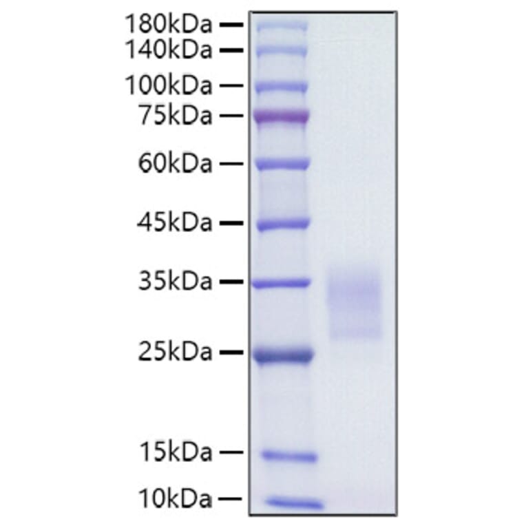 SDS-PAGE - Recombinant Human CD7 Protein (C-terminal His Tag) (A330387) - Antibodies.com