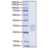 SDS-PAGE - Recombinant Human CD7 Protein (C-terminal His Tag) (A330387) - Antibodies.com