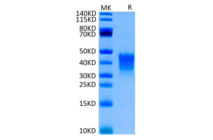 Tris-Bis PAGE - Recombinant Human CD7 Protein (Biotin) (C-terminal His and Avi Tag) (A330388) - Antibodies.com
