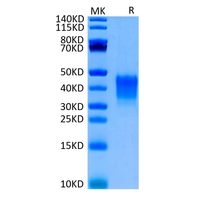 Tris-Bis PAGE - Recombinant Human CD7 Protein (Biotin) (C-terminal His and Avi Tag) (A330388) - Antibodies.com