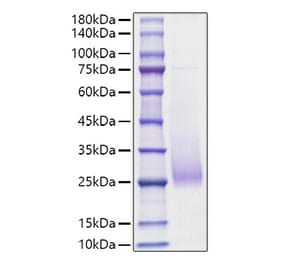 SDS-PAGE - Recombinant Human CD70 Protein (N-terminal His Tag) (A330389) - Antibodies.com