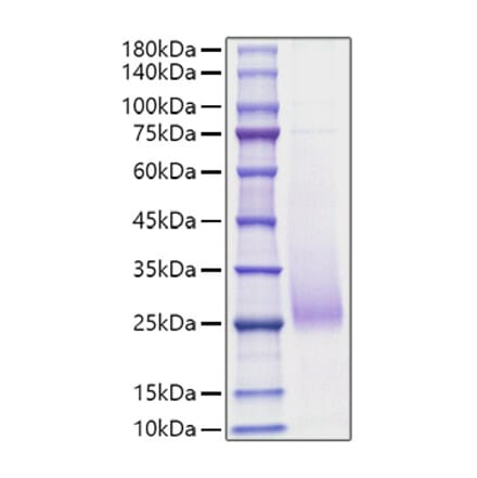SDS-PAGE - Recombinant Human CD70 Protein (N-terminal His Tag) (A330389) - Antibodies.com