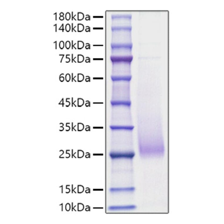 SDS-PAGE - Recombinant Human CD70 Protein (N-terminal His Tag) (A330389) - Antibodies.com