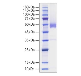 SDS-PAGE - Recombinant Human CD70 Protein (N-terminal Human Fc Tag) (A330390) - Antibodies.com