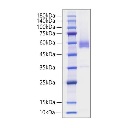 SDS-PAGE - Recombinant Human CD70 Protein (N-terminal Human Fc Tag) (A330390) - Antibodies.com