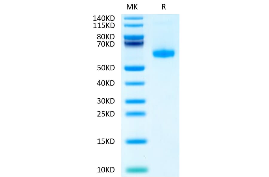Tris-Bis PAGE - Recombinant Human CD70 Protein (Biotin) (N-terminal His Tag) (A330391) - Antibodies.com