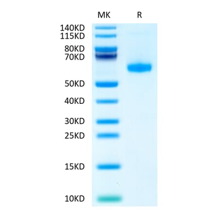 Tris-Bis PAGE - Recombinant Human CD70 Protein (Biotin) (N-terminal His Tag) (A330391) - Antibodies.com