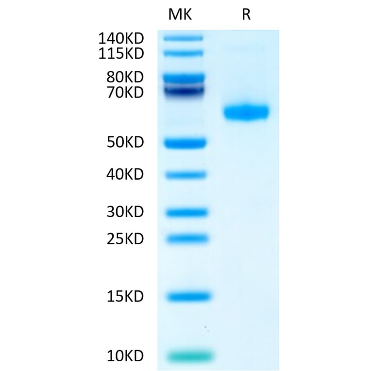 Tris-Bis PAGE - Recombinant Human CD70 Protein (Biotin) (N-terminal His Tag) (A330391) - Antibodies.com