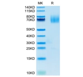 Tris-Bis PAGE - Recombinant Human CD70 Protein (N-terminal Human Fc Tag) (A330392) - Antibodies.com