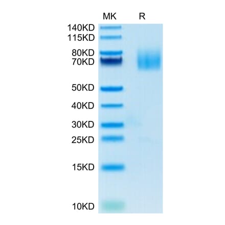 Tris-Bis PAGE - Recombinant Human CD70 Protein (N-terminal Human Fc Tag) (A330392) - Antibodies.com