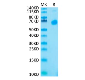 Tris-Bis PAGE - Recombinant Human CD70 Protein (N-terminal His Tag) (A330393) - Antibodies.com