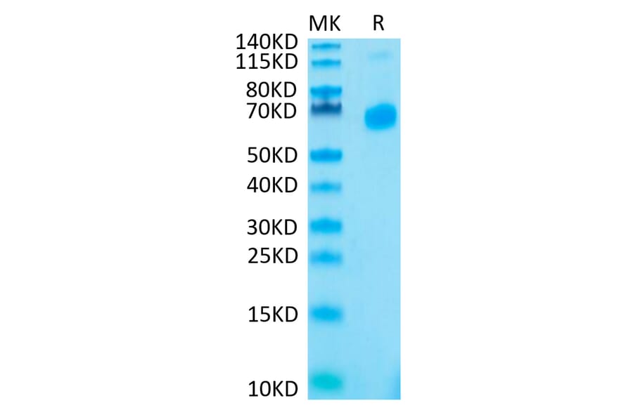 Tris-Bis PAGE - Recombinant Human CD70 Protein (N-terminal His Tag) (A330393) - Antibodies.com