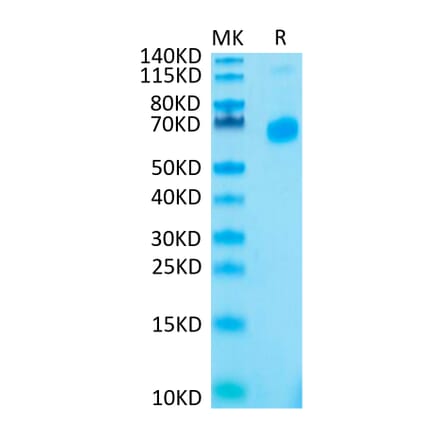 Tris-Bis PAGE - Recombinant Human CD70 Protein (N-terminal His Tag) (A330393) - Antibodies.com
