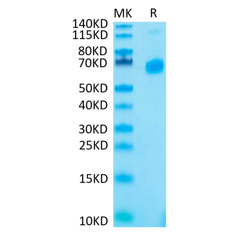 Tris-Bis PAGE - Recombinant Human CD70 Protein (N-terminal His Tag) (A330393) - Antibodies.com