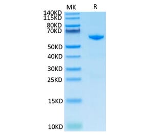 Tris-Bis PAGE - Recombinant Cynomolgus macaque CD73 Protein (C-terminal His Tag) (A330394) - Antibodies.com