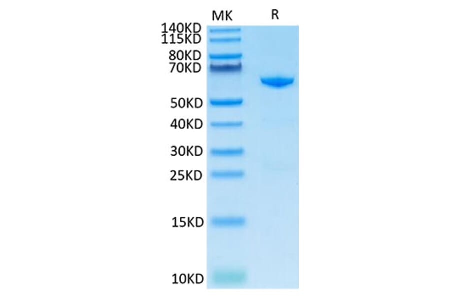 Tris-Bis PAGE - Recombinant Cynomolgus macaque CD73 Protein (C-terminal His Tag) (A330394) - Antibodies.com
