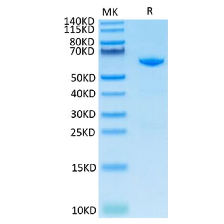 Tris-Bis PAGE - Recombinant Cynomolgus macaque CD73 Protein (C-terminal His Tag) (A330394) - Antibodies.com