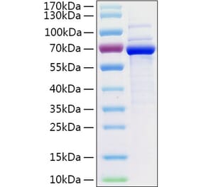 SDS-PAGE - Recombinant Human CD73 Protein (C-terminal His Tag) (A330395) - Antibodies.com