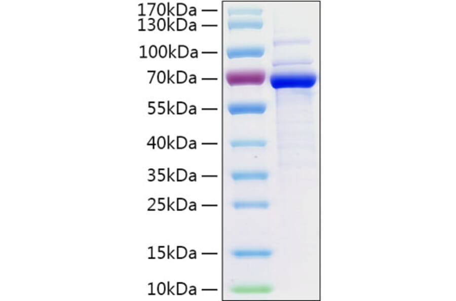 SDS-PAGE - Recombinant Human CD73 Protein (C-terminal His Tag) (A330395) - Antibodies.com