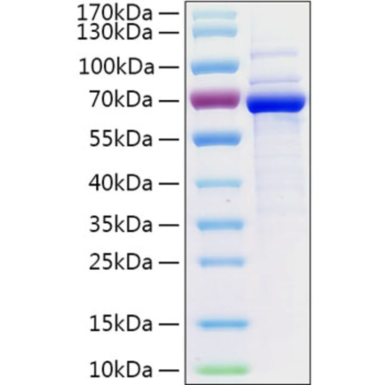 SDS-PAGE - Recombinant Human CD73 Protein (C-terminal His Tag) (A330395) - Antibodies.com