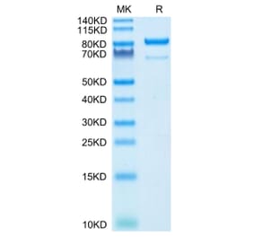 Tris-Bis PAGE - Recombinant Human CD73 Protein (C-terminal Human Fc Tag) (A330396) - Antibodies.com