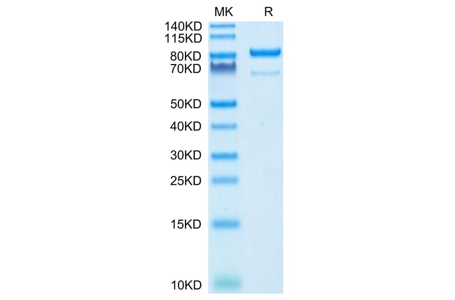 Tris-Bis PAGE - Recombinant Human CD73 Protein (C-terminal Human Fc Tag) (A330396) - Antibodies.com