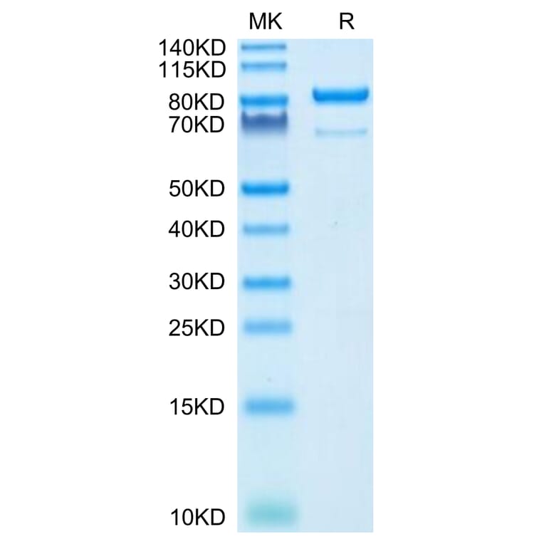 Tris-Bis PAGE - Recombinant Human CD73 Protein (C-terminal Human Fc Tag) (A330396) - Antibodies.com